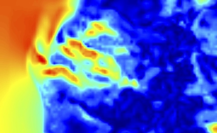 Componente Meteorologica